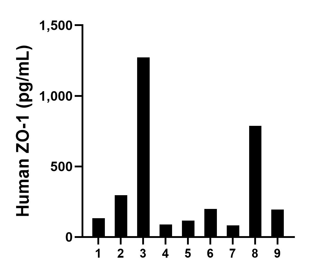 Serum of nine individual healthy human donors was measured. The ZO-1 concentration of detected samples was determined to be 352.4 pg/mL with a range of 83.4 - 1,272.8 pg/mL.